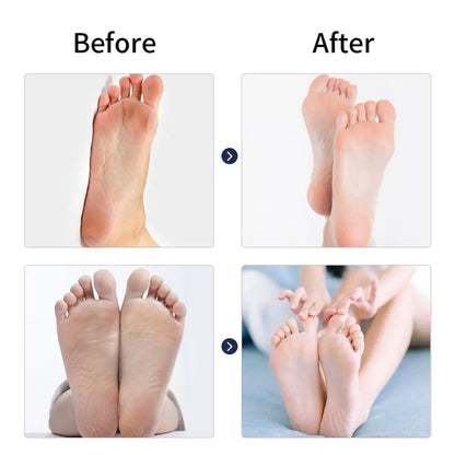 Electric Feet Callus Remover